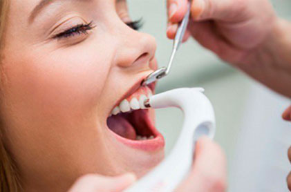 Limpieza Dental Profesional