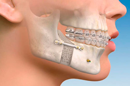 Cirugía Maxilofacial